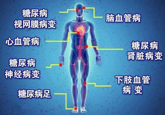 糖尿病并发症的详细介绍