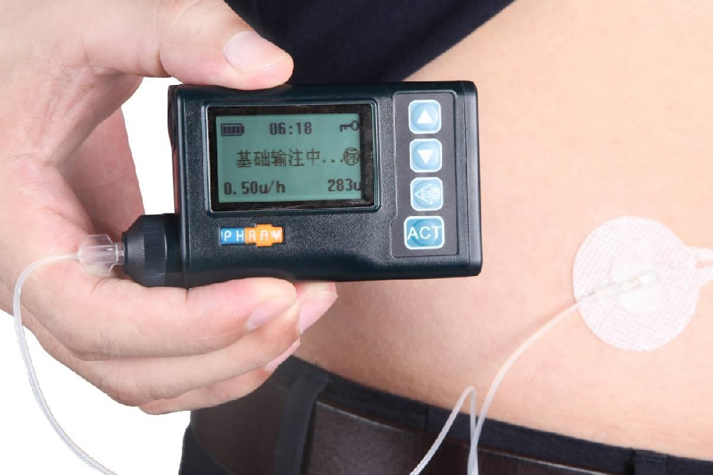 夏季使用胰岛素泵需要注意些什么？