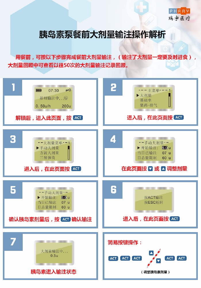 优泵小讲堂 | 餐前大剂量输注操作解析