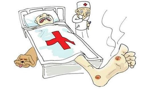 糖足筛查？来了解一下