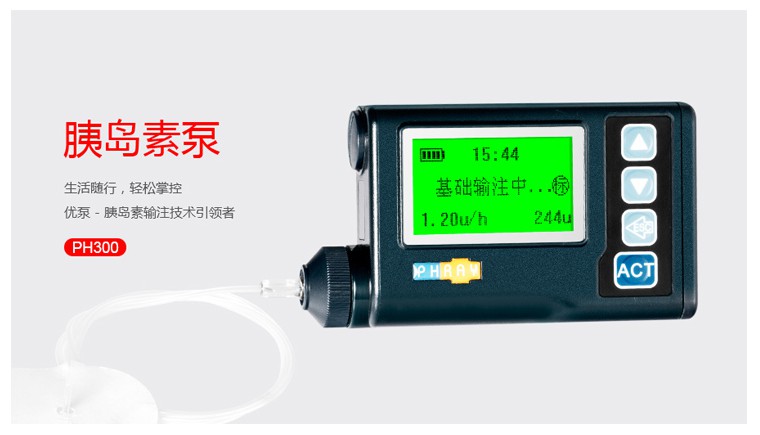 胰岛素泵如何选择？注意什么要点？