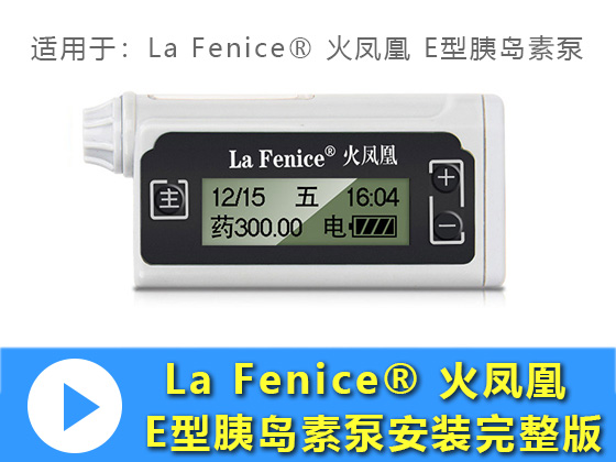 La Fenice® 火凤凰 E型胰岛素泵安装完整版